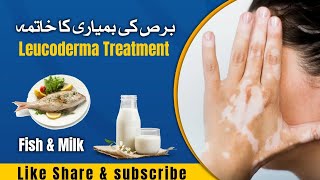 Leucoderma Treatment  برص کی بمیاری کا خاتما  Salty Milk  Milk And Fish  رایتہ [upl. by Aicineohp]