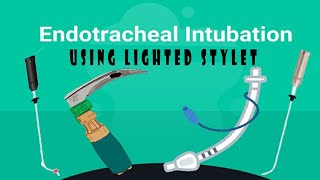 Lighted stylet  Endotracheal intubation [upl. by Johny]