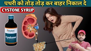 Cystone syrup use dose benefits and side effects full review in hindi [upl. by Airtap335]