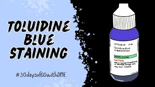 TOLUIDINE BLUE STAINING IN ORAL SURGERY  30daysofOSwithDME [upl. by Alleunamme577]