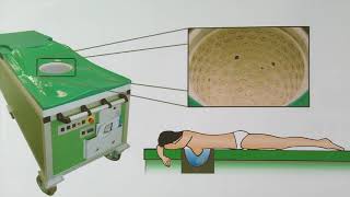 Mammographie Neue BrustkrebsVorsorgeuntersuchung ohne Strahlen und Schmerzen [upl. by Goldshlag]