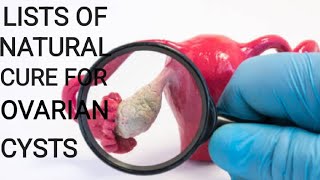 Causes of Ovarian Cyst Symptoms and Natural Treatment [upl. by Earl]