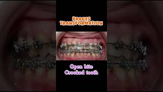 dental dentalclinic trending orthodontist dentist smile dentition yt shorts dentistry [upl. by Engle120]