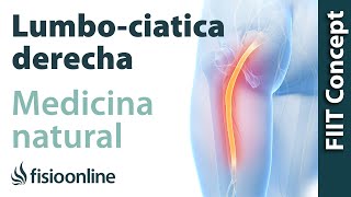 Ciáticalumbociática derecha  Visión desde la fisioterapia y la medicina natural [upl. by Wemolohtrab829]