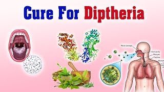 Diphtheria गलघोटू  Ayurvedic Treatment  Symptoms and Causes [upl. by Nolyk374]