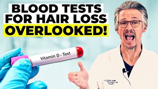 BLOOD TESTS FOR HAIR LOSS THE CRITICAL BLOOD TESTS YOU NEED NOW [upl. by Shuma]