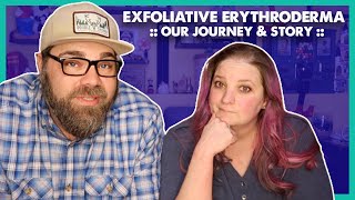 Exfoliative Erythroderma  Our Journey amp Story GRAPHIC IMAGES [upl. by Manouch604]