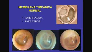 Tmmed otorrinolaringología  1 OTORRINOLARINGOLOGIA DR SALAZAR I 1 [upl. by Darya938]