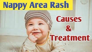 Nappy Area Rash Causes Symptoms Diagnosis amp Treatment [upl. by Eugenle157]