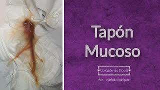 👁‍🗨 TAPON MUCOSO ✅ Cuanto Falta para El Parto [upl. by Eenahc927]