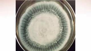 Identification of Filamentous Fungi Hyaline Monomorphic Fungi Part 5 Hot Topic [upl. by Rumpf]