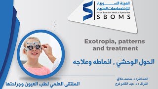 Exotropia patterns and treatment  الحول الوحشي انماطه وعلاجه [upl. by Enyalaj]