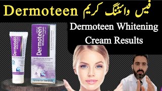 Dermoteen Whitening Cream Review Hand and Foot Whitening cream In Pakistan [upl. by Rennie]