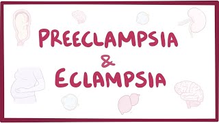 Preeclampsia amp eclampsia  causes symptoms diagnosis treatment pathology [upl. by Sabella]