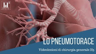 Lo pneumotorace  quadro clinico diagnosi e terapia [upl. by Inneg]