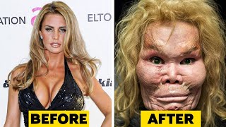 20 Celebrity Plastic Surgery Disasters [upl. by Itsirk]