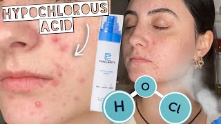 HYPOCHLOROUS ACID Sensitive Skin Ingredient for Acne amp Wound Healing PurClarity Revitalizing Mist [upl. by Rabassa585]