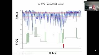 EPISODIOS DE HIPOXEMIA EN EL PREMATURO [upl. by Rodman696]