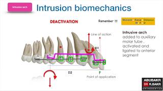 Intrusion biomechanics [upl. by Eellehs]