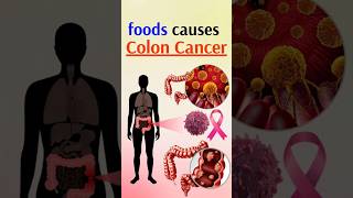 CANCER Causing Foods You Eat Every Day [upl. by Danas]