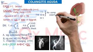 Ficha resumen Cirugía general Colangitis aguda ENAMENARMSERUMS [upl. by Girardo796]