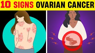 10 Ovarian Cancer Signs 90 of Women Ignore [upl. by Aivun]