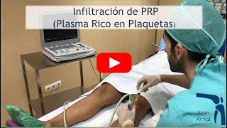 Infiltración Plasma Rico en Plaquetas PRP en TENDÓN ROTULIANO [upl. by Adaha]