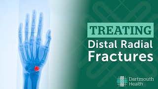 Treating Distal Radius Fractures at Dartmouth Health [upl. by Holsworth]