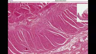 Anatomy  Histology of the Colon Large Intestine [upl. by Ayeka]