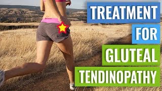 Treatment for Gluteal Tendinopathy [upl. by Asilrahc800]