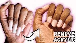 How to REMOVE ACRYLIC NAILS AT HOME  TAKE OFF ACRYLIC NAILS with ACETONE [upl. by Mori383]