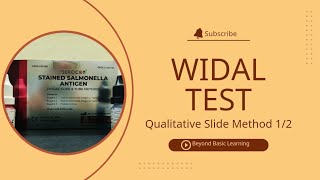 Widal Test  Qualitative Slide method  12 [upl. by Airdnat]