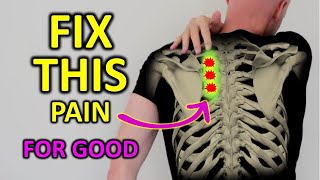 Fix Rhomboid Pain For Good Shoulder Blade Pain [upl. by Zohar]