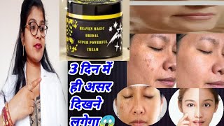 Heaven Magic Bridal Super Powerful Face Cream Honest Review  2024  Bridal Face Cream Review Hindi [upl. by Adnalram]