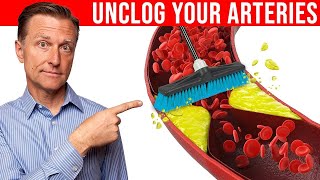 The 1 Best Remedy to Clean Plaque From Your Arteries [upl. by Nahtam371]