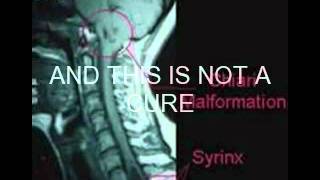 Chiari awareness video [upl. by Zerlina]