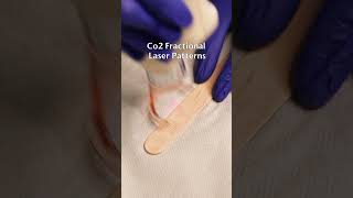 CO2 Fractional Laser Patterns  Skin Rejuvenation Laser Treatment [upl. by Arliene47]