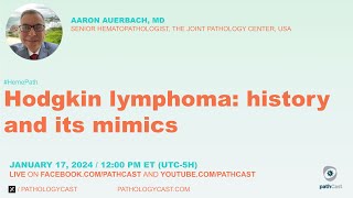 Hodgkin Lymphoma history and its mimics [upl. by Pasol]