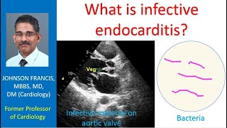 What is infective endocarditis Infection of heart valves [upl. by Miahc]