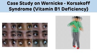 Case Study On Wernicke Korsakoff Syndrome Vitamin B1 Deficiency  Biochemistry Case Study [upl. by Allebasi]