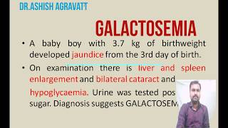 Galactosemia  Galactose metabolism  Biochemistry [upl. by Erich161]