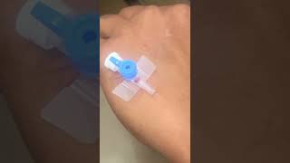 IV cannula insertiondocternursingtrendingforyouyoutubelovepopularviralvideoshortvideo [upl. by Mor]