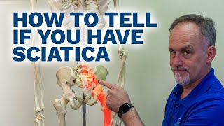 How can you tell if you have Sciatica Check out 2 easy tests to tell if you have Sciatica at home [upl. by Eihcra450]