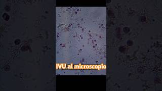 Así se ve una muestra de orina cuando hay INFECCIÓN laboratorioclinico uroanalisis short [upl. by Azeria572]