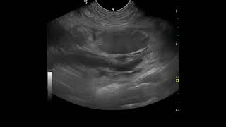 mesenteric torsion in a dog oedemahaemorrhage in the root of the mesentery [upl. by Nirot]