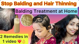 Stop Balding And Hair Thinning👍2 Remedies in 1 Video👌Hair Mask and Toner🥰viralvideotrendinghair [upl. by Coppins]