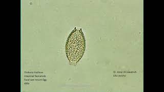 Trichuris trichiura Intestinal Nematode egg [upl. by Jer328]