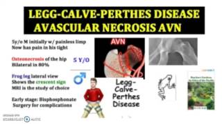 What is avascular necrosis AVN causes symptoms amp pathology in 3 minutes [upl. by Enenaj]