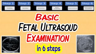 Basic Fetal Ultrasound Examination [upl. by Kared]