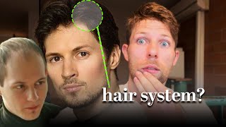 Super Famous Billionaire Is Wearing a HAIR SYSTEM [upl. by Goeselt]